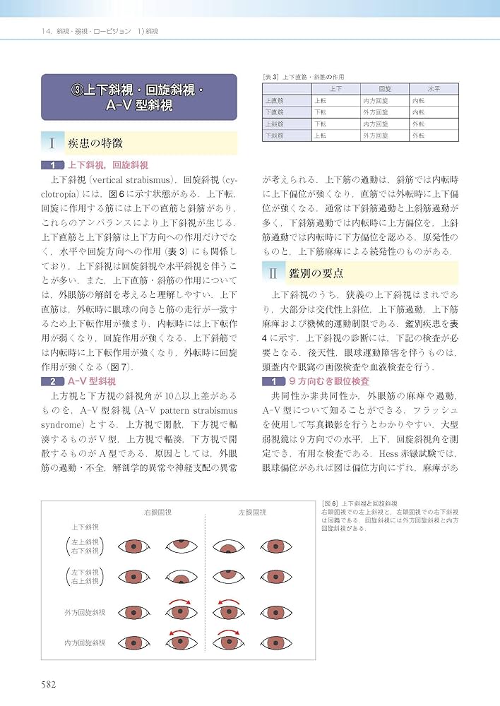 眼科診療ガイド 第2版 眼科診療ガイド 第2版 | 根木 昭 |本 | 通販 | Amazon